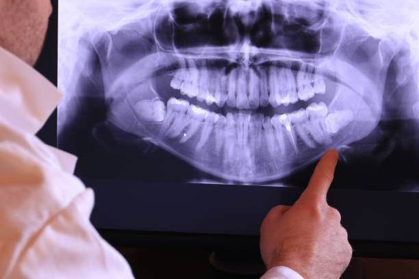 Best Knocked-Out Tooth Emergency  in Peoria Heights, IL