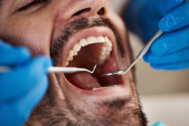 Best Tooth Infection Emergency Dentist  in Peoria Heights, IL